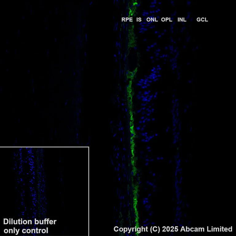 Immunohistochemistry (Formalin/PFA-fixed paraffin-embedded sections) - Alexa Fluor® 488 Anti-RPE65 antibody [EPR22579-44] (AB323751)