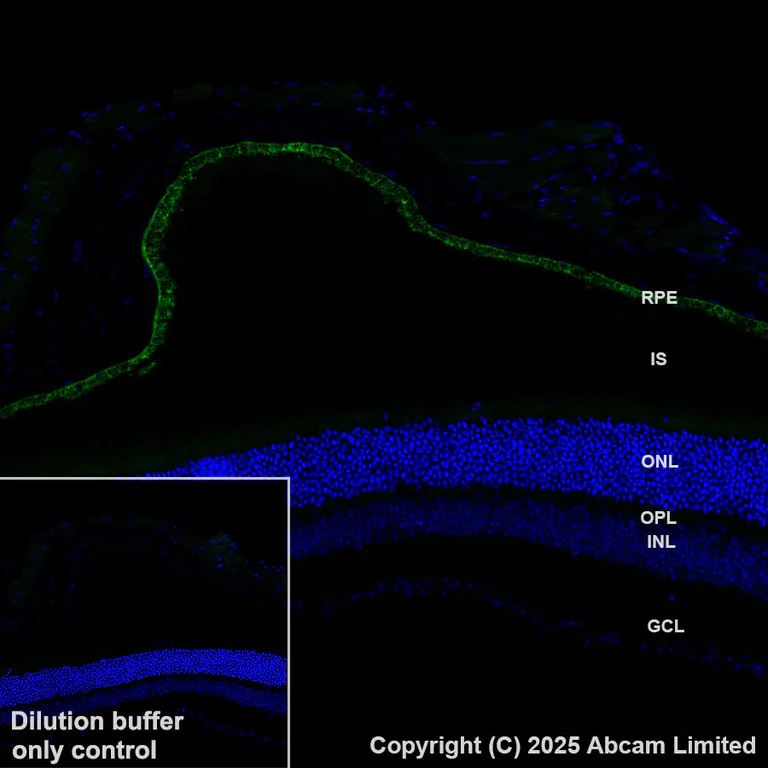 Immunohistochemistry (Formalin/PFA-fixed paraffin-embedded sections) - Alexa Fluor® 488 Anti-RPE65 antibody [EPR22579-44] (AB323751)