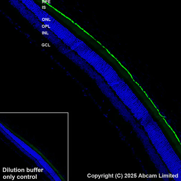 Immunohistochemistry (Formalin/PFA-fixed paraffin-embedded sections) - Alexa Fluor® 488 Anti-RPE65 antibody [EPR22579-44] (AB323751)
