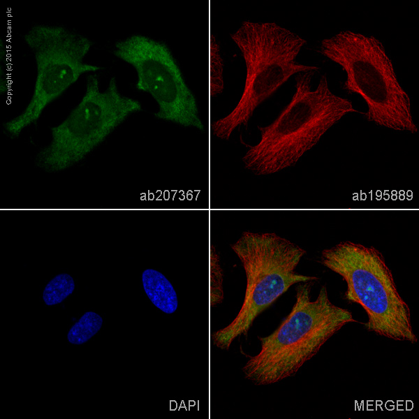 Immunocytochemistry/ Immunofluorescence - Alexa Fluor® 488 Anti-S100 alpha antibody [EPR5251] (AB207367)