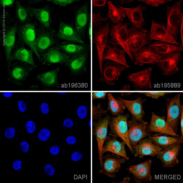 Immunocytochemistry/ Immunofluorescence - Alexa Fluor® 488 Anti-S100A4 antibody [EPR2761(2)] (AB196380)