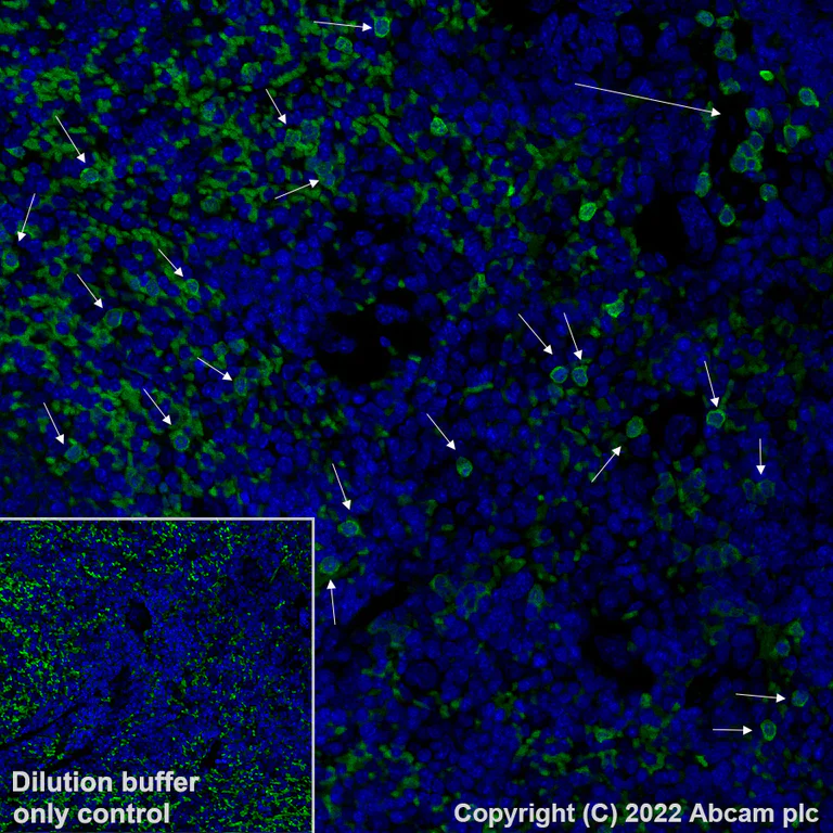 Immunohistochemistry (Formalin/PFA-fixed paraffin-embedded sections) - Alexa Fluor® 488 Anti-S100A9 antibody [EPR22332-75] (AB307395)