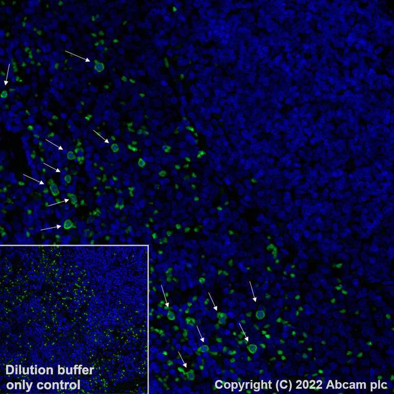 Immunohistochemistry (Formalin/PFA-fixed paraffin-embedded sections) - Alexa Fluor® 488 Anti-S100A9 antibody [EPR22332-75] (AB307395)