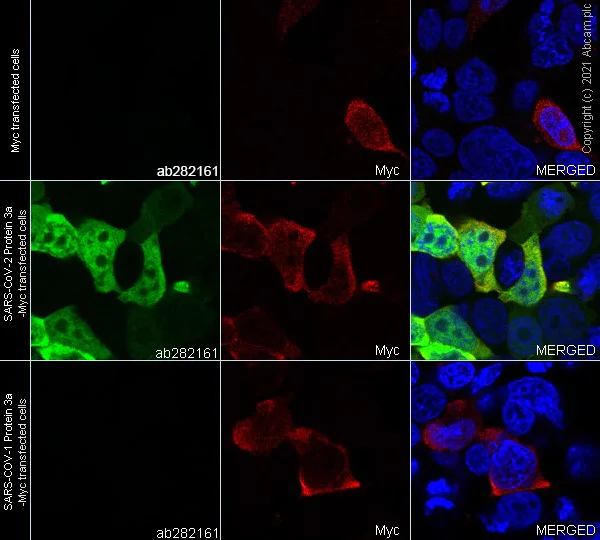 Immunocytochemistry/ Immunofluorescence - Alexa Fluor® 488 Anti-SARS CoV-2 ORF3a Protein antibody [EPR24848-9] (AB282161)