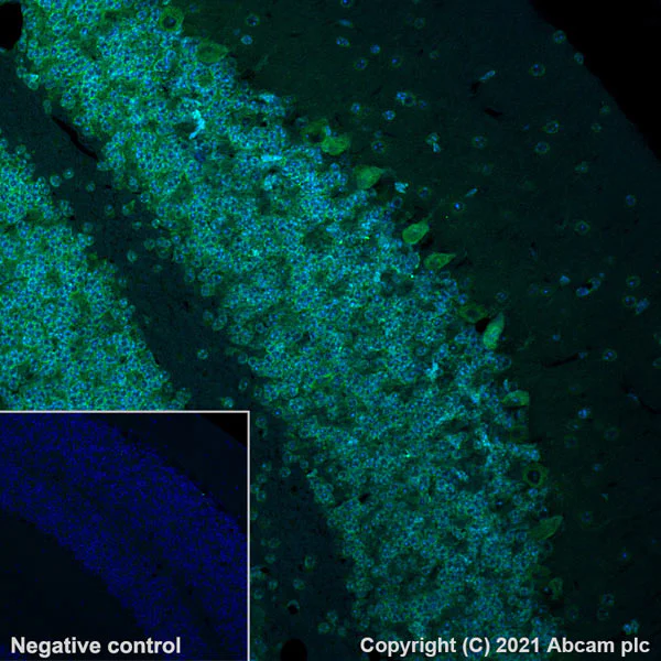 Immunohistochemistry (Formalin/PFA-fixed paraffin-embedded sections) - Alexa Fluor® 488 Anti-SCA2 antibody [EPR23630-49] (AB300055)