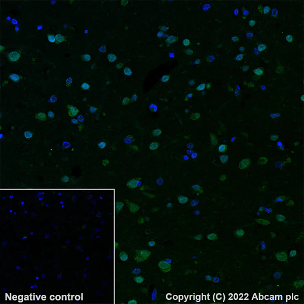 Immunohistochemistry (Formalin/PFA-fixed paraffin-embedded sections) - Alexa Fluor® 488 Anti-SCA2 antibody [EPR23630-49] (AB300055)