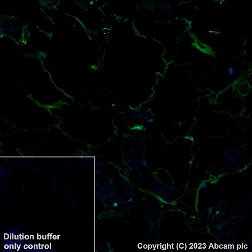 Immunohistochemistry (Formalin/PFA-fixed paraffin-embedded sections) - Alexa Fluor® 488 Anti-SCD1 antibody [EPR21963] (AB315182), expandable thumbnail