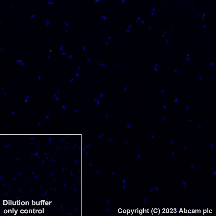 Immunohistochemistry (Formalin/PFA-fixed paraffin-embedded sections) - Alexa Fluor® 488 Anti-SCD1 antibody [EPR21963] (AB315182), expandable thumbnail