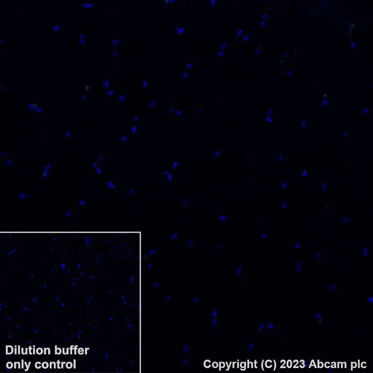 Immunohistochemistry (Formalin/PFA-fixed paraffin-embedded sections) - Alexa Fluor® 488 Anti-SCD1 antibody [EPR21963] (AB315182)