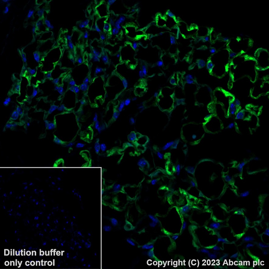 Immunohistochemistry (Formalin/PFA-fixed paraffin-embedded sections) - Alexa Fluor® 488 Anti-SCD1 antibody [EPR21963] (AB315182), expandable thumbnail