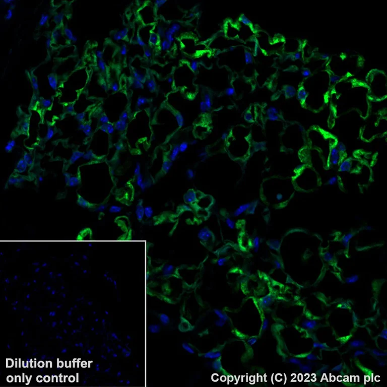 Immunohistochemistry (Formalin/PFA-fixed paraffin-embedded sections) - Alexa Fluor® 488 Anti-SCD1 antibody [EPR21963] (AB315182)