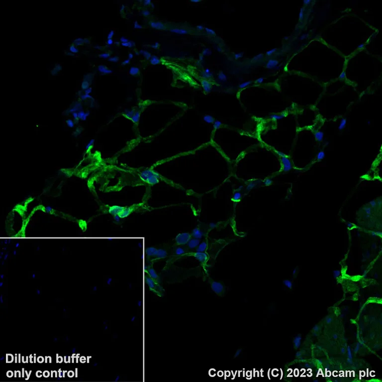 Immunohistochemistry (Formalin/PFA-fixed paraffin-embedded sections) - Alexa Fluor® 488 Anti-SCD1 antibody [EPR21963] (AB315182)