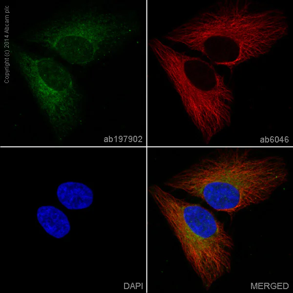 Immunocytochemistry/ Immunofluorescence - Alexa Fluor® 488 Anti-SDHB antibody [21A11AE7] (AB197902)