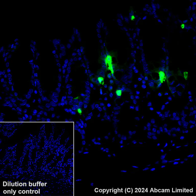 Immunohistochemistry (Formalin/PFA-fixed paraffin-embedded sections) - Alexa Fluor® 488 Anti-Serotonin antibody [EPR24431-201] (AB321853)
