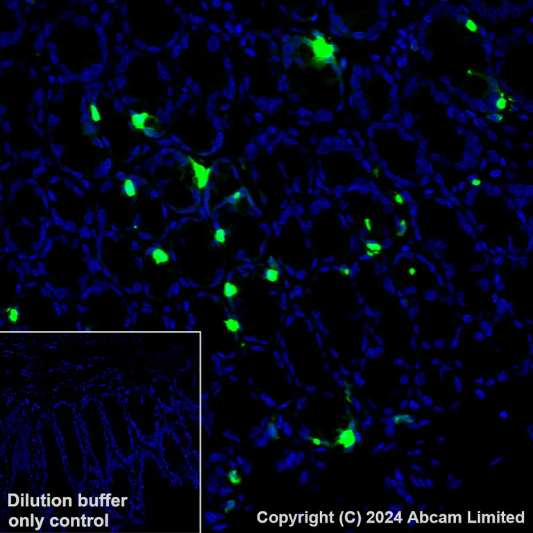 Immunohistochemistry (Formalin/PFA-fixed paraffin-embedded sections) - Alexa Fluor® 488 Anti-Serotonin antibody [EPR24431-201] (AB321853)