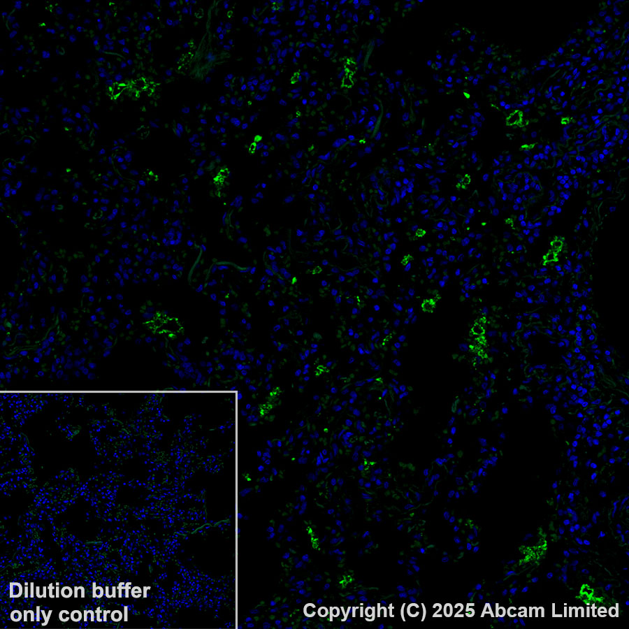 Immunohistochemistry (Formalin/PFA-fixed paraffin-embedded sections) - Alexa Fluor® 488 Anti-SFTPA1 + SFTPA2 antibody [EPR29098-6] (AB323898), expandable thumbnail