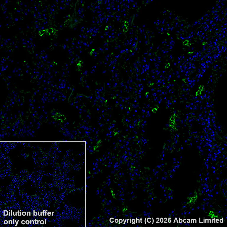 Immunohistochemistry (Formalin/PFA-fixed paraffin-embedded sections) - Alexa Fluor® 488 Anti-SFTPA1 + SFTPA2 antibody [EPR29098-6] (AB323898)