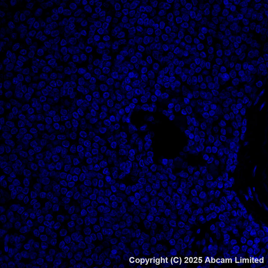 Immunohistochemistry (Formalin/PFA-fixed paraffin-embedded sections) - Alexa Fluor® 488 Anti-SFTPA1 + SFTPA2 antibody [EPR29098-6] (AB323898), expandable thumbnail