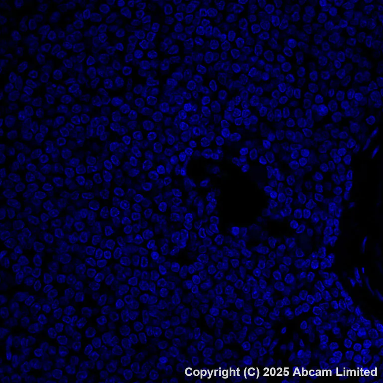 Immunohistochemistry (Formalin/PFA-fixed paraffin-embedded sections) - Alexa Fluor® 488 Anti-SFTPA1 + SFTPA2 antibody [EPR29098-6] (AB323898)