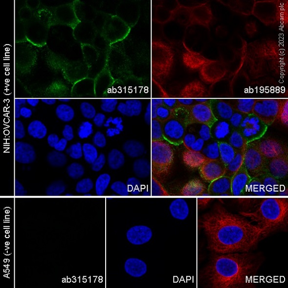 Immunocytochemistry/ Immunofluorescence - Alexa Fluor® 488 Anti-SLC34A2 - N-terminal antibody [SP322] (AB315178), expandable thumbnail