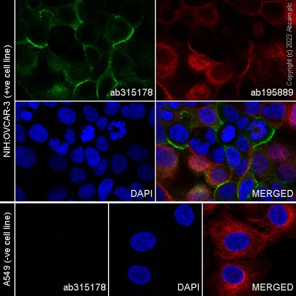 Immunocytochemistry/ Immunofluorescence - Alexa Fluor® 488 Anti-SLC34A2 - N-terminal antibody [SP322] (AB315178)