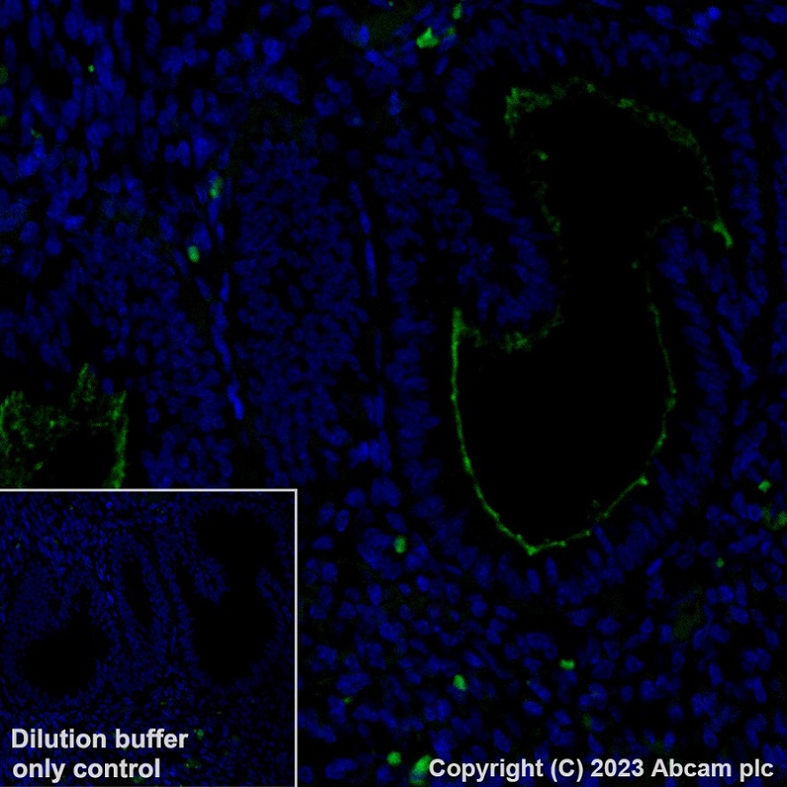 Immunohistochemistry (Formalin/PFA-fixed paraffin-embedded sections) - Alexa Fluor® 488 Anti-SLC34A2 - N-terminal antibody [SP322] (AB315178), expandable thumbnail