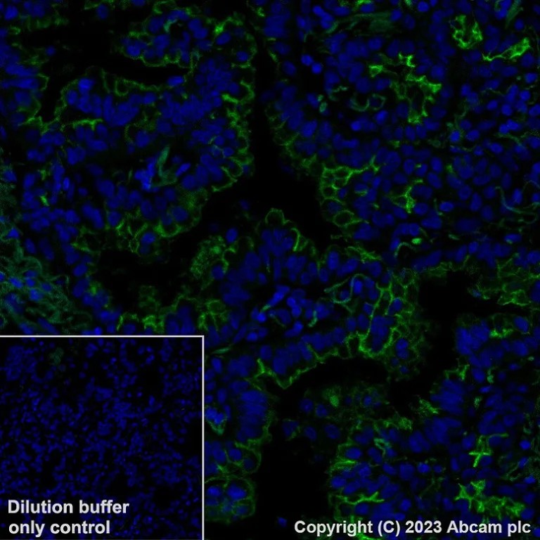 Immunohistochemistry (Formalin/PFA-fixed paraffin-embedded sections) - Alexa Fluor® 488 Anti-SLC34A2 - N-terminal antibody [SP322] (AB315178)