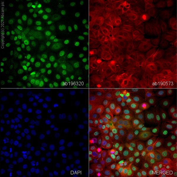 Immunocytochemistry/ Immunofluorescence - Alexa Fluor® 488 Anti-Smad2 antibody [EP567Y] (AB196320), expandable thumbnail