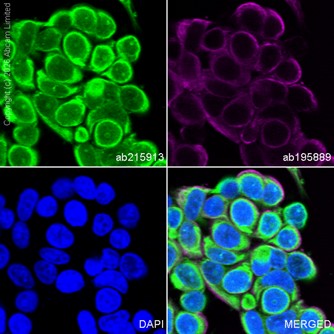 Immunocytochemistry/ Immunofluorescence - Alexa Fluor® 488 Anti-Smad2 antibody [EP784Y] (AB215913)