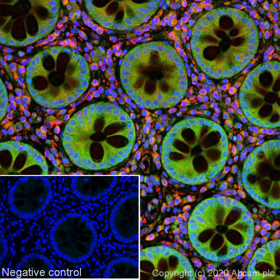 Immunohistochemistry (Formalin/PFA-fixed paraffin-embedded sections) - Alexa Fluor® 488 Anti-Smad4 antibody [SP306] - C-terminal (AB267520), expandable thumbnail