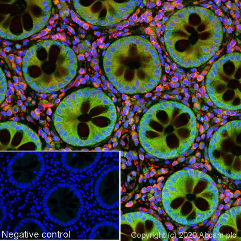 Immunohistochemistry (Formalin/PFA-fixed paraffin-embedded sections) - Alexa Fluor® 488 Anti-Smad4 antibody [SP306] - C-terminal (AB267520)