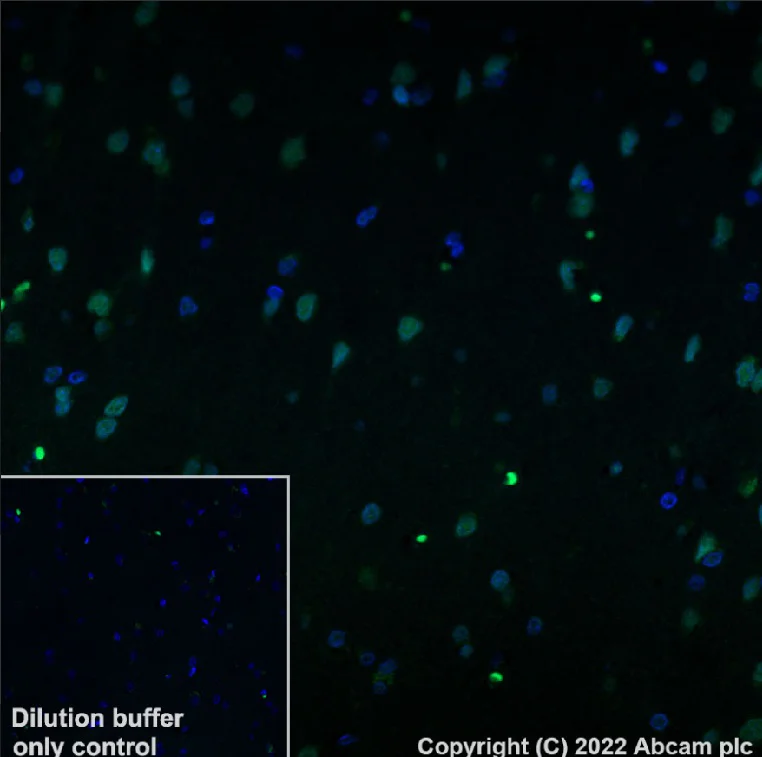 Immunohistochemistry (Formalin/PFA-fixed paraffin-embedded sections) - Alexa Fluor® 488 Anti-SMARCA2 / BRM antibody [EPR23103-44] (AB307770)