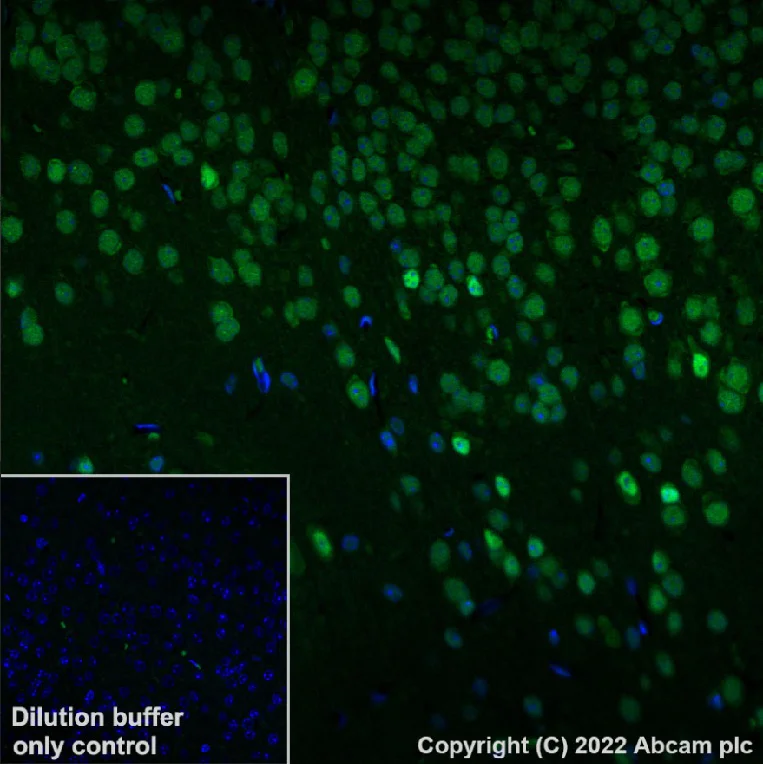 Immunohistochemistry (Formalin/PFA-fixed paraffin-embedded sections) - Alexa Fluor® 488 Anti-SMARCA2 / BRM antibody [EPR23103-44] (AB307770)