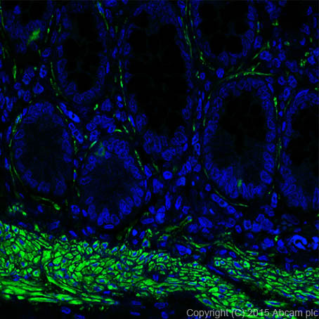 Immunohistochemistry (Formalin/PFA-fixed paraffin-embedded sections) - Alexa Fluor® 488 Anti-smooth muscle Myosin heavy chain 11 antibody [EPR5336(B)] (AB197524)