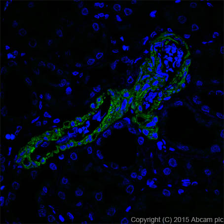 Immunohistochemistry (Formalin/PFA-fixed paraffin-embedded sections) - Alexa Fluor® 488 Anti-smooth muscle Myosin heavy chain 11 antibody [EPR5336(B)] (AB197524)