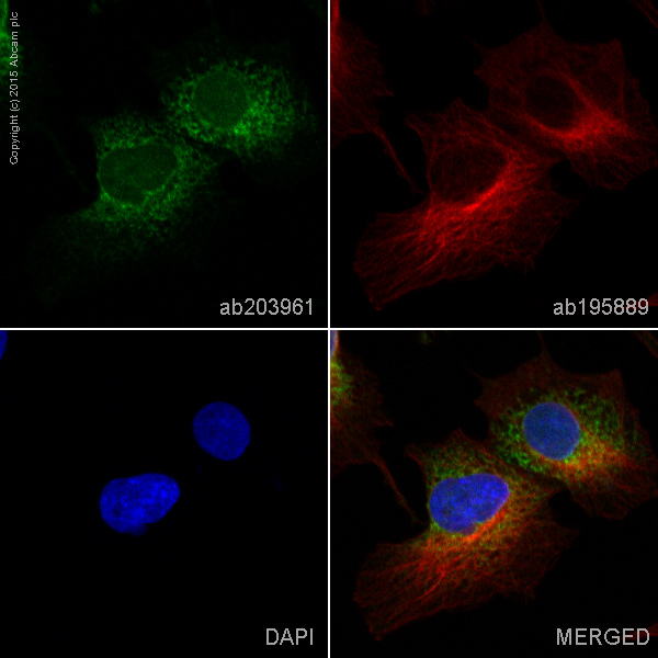 Immunocytochemistry/ Immunofluorescence - Alexa Fluor® 488 Anti-Sonic Hedgehog antibody [EP1190Y] (AB203961), expandable thumbnail