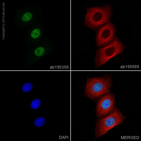 Immunocytochemistry/ Immunofluorescence - Alexa Fluor® 488 Anti-SOX2 antibody [EPR3131] (AB195358)