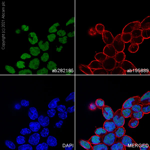 Immunocytochemistry/ Immunofluorescence - Alexa Fluor® 488 Anti-SOX2 antibody [SP76] (AB282185)