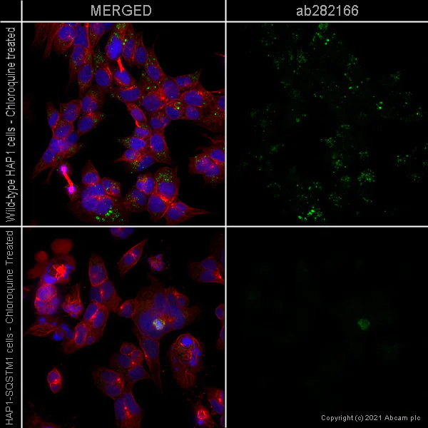 Immunocytochemistry - Alexa Fluor® 488 Anti-SQSTM1 / p62 antibody [EPR23101-103] - Autophagosome Marker (AB282166)