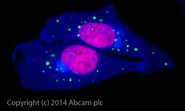 Immunocytochemistry/ Immunofluorescence - Alexa Fluor® 488 Anti-SQSTM1 / p62 antibody [EPR4844] - Autophagosome Marker (AB185015)