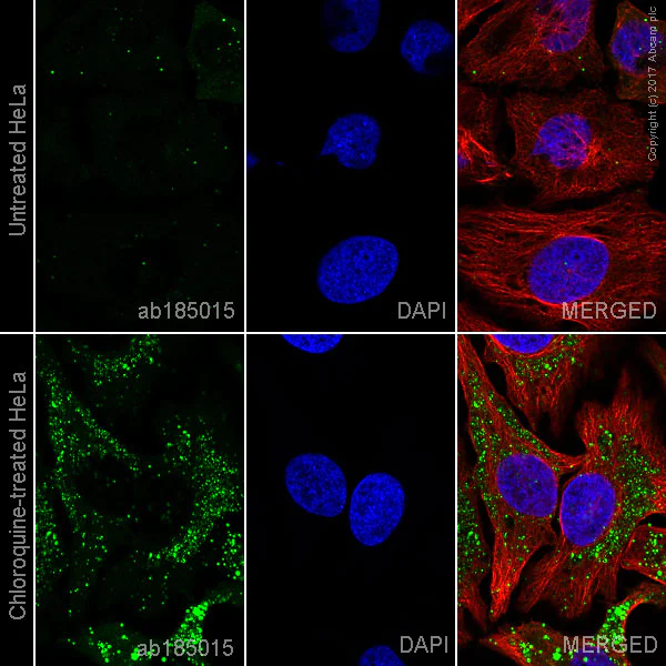 Immunocytochemistry/ Immunofluorescence - Alexa Fluor® 488 Anti-SQSTM1 / p62 antibody [EPR4844] - Autophagosome Marker (AB185015)