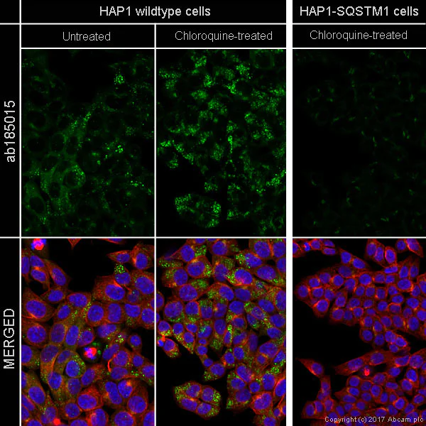 Immunocytochemistry/ Immunofluorescence - Alexa Fluor® 488 Anti-SQSTM1 / p62 antibody [EPR4844] - Autophagosome Marker (AB185015)