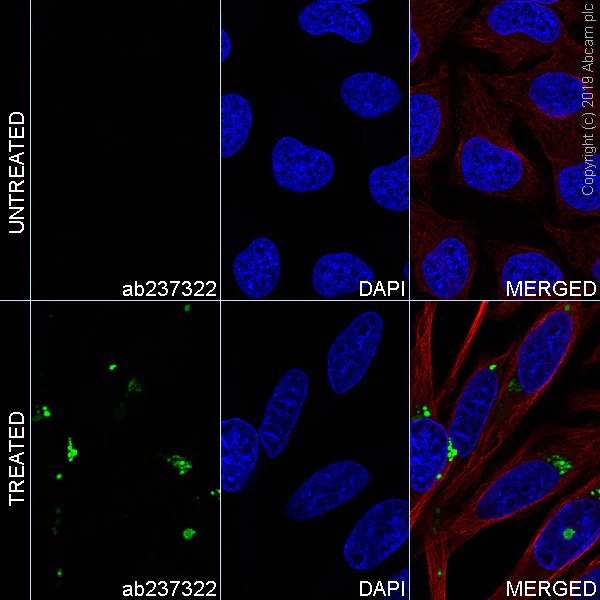Immunocytochemistry/ Immunofluorescence - Alexa Fluor® 488 Anti-SQSTM1 / p62 (phospho S349) antibody [EPR20451] (AB237322)