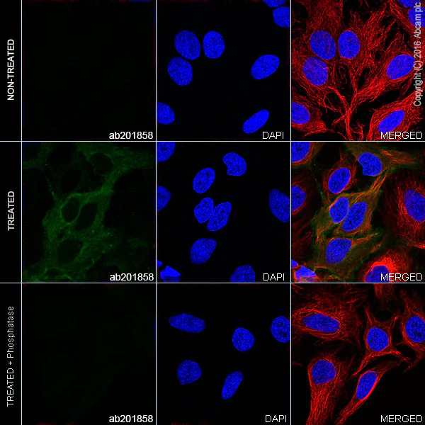 Immunocytochemistry/ Immunofluorescence - Alexa Fluor® 488 Anti-SRC Family (phospho Y418) antibody [EP503Y] (AB201858)