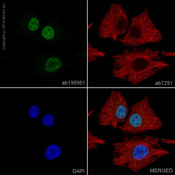 Immunocytochemistry/ Immunofluorescence - Alexa Fluor® 488 Anti-SUN2 antibody [EPR6557] (AB198981)