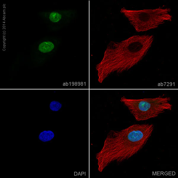 Immunocytochemistry/ Immunofluorescence - Alexa Fluor® 488 Anti-SUN2 antibody [EPR6557] (AB198981)