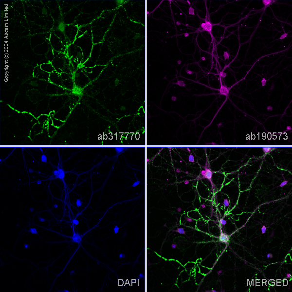 Immunocytochemistry/ Immunofluorescence - Alexa Fluor® 488 Anti-SV2A antibody [EPR23500-32] (AB317770), expandable thumbnail