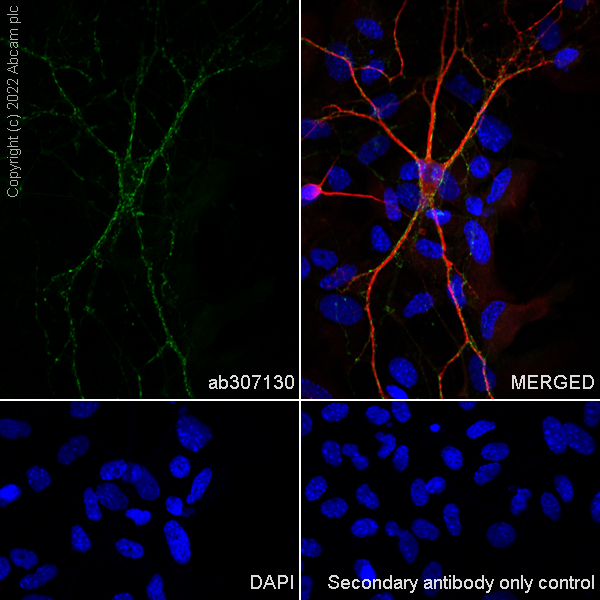 Immunocytochemistry/ Immunofluorescence - Alexa Fluor® 488 Anti-Synapsin I antibody [EPR23531-50] - Synaptic Marker (AB307130), expandable thumbnail