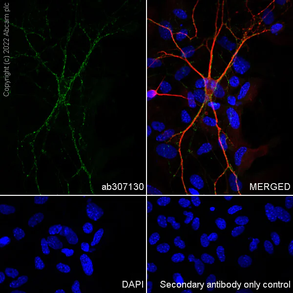 Immunocytochemistry/ Immunofluorescence - Alexa Fluor® 488 Anti-Synapsin I antibody [EPR23531-50] - Synaptic Marker (AB307130)