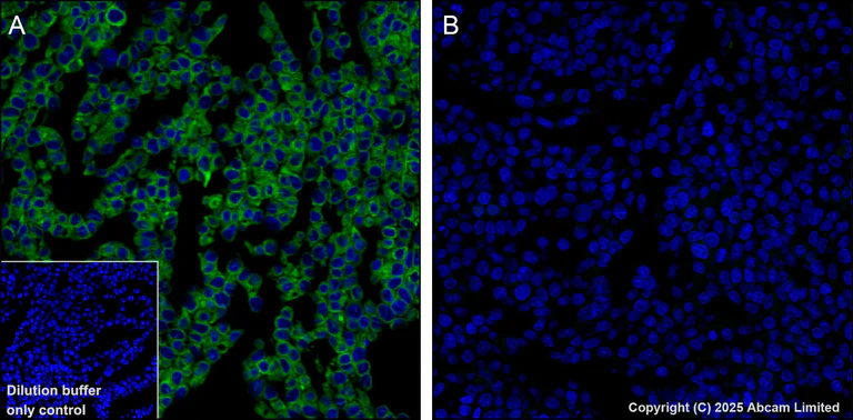 Immunohistochemistry (Formalin/PFA-fixed paraffin-embedded sections) - Alexa Fluor® 488 Anti-TAP1 antibody [EPR26236-92] (AB325699)